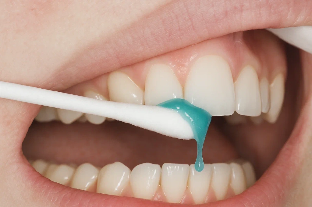 Аппликационная (терминальная, поверхностная) анестезия