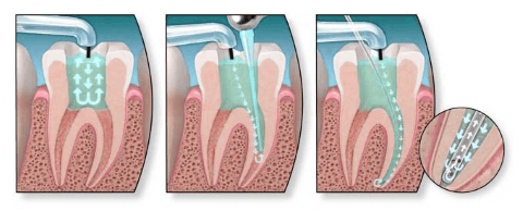 Противопоказание к депофорезу в стоматологии thumbnail