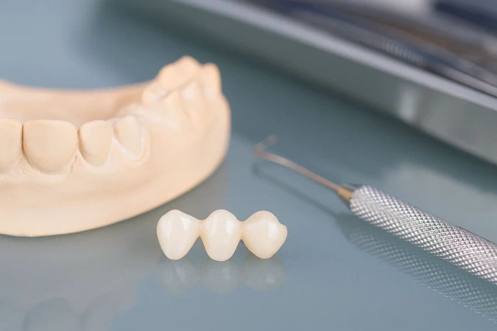 Металлопластмассовые коронки на зубы