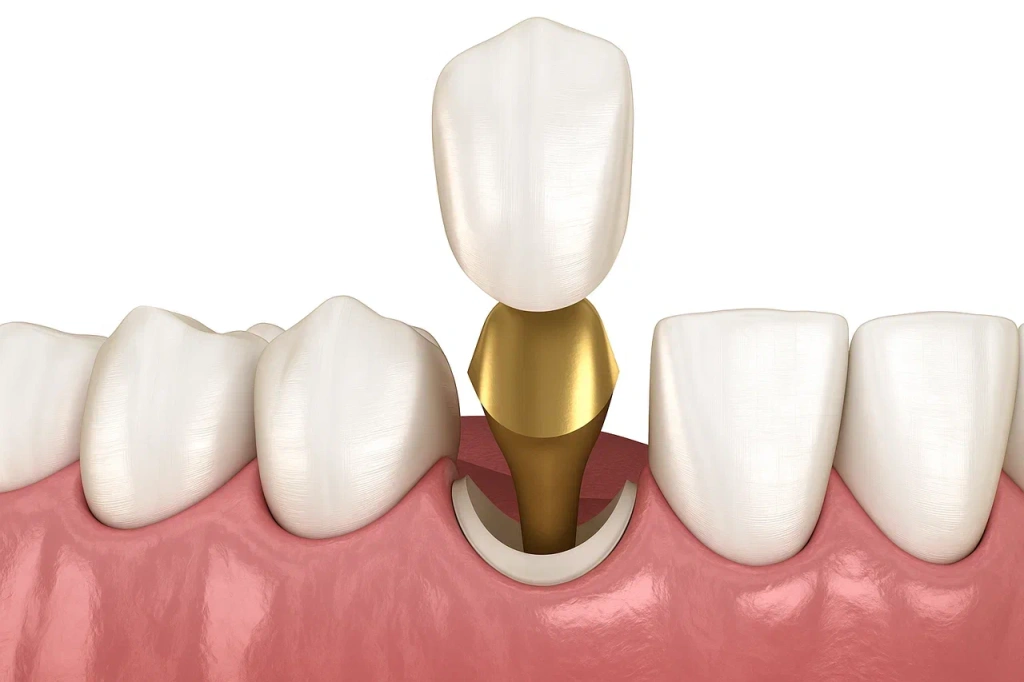 Культевая вкладка