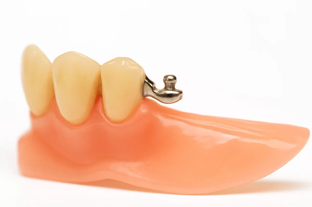 Бюгельный протез на аттачментах